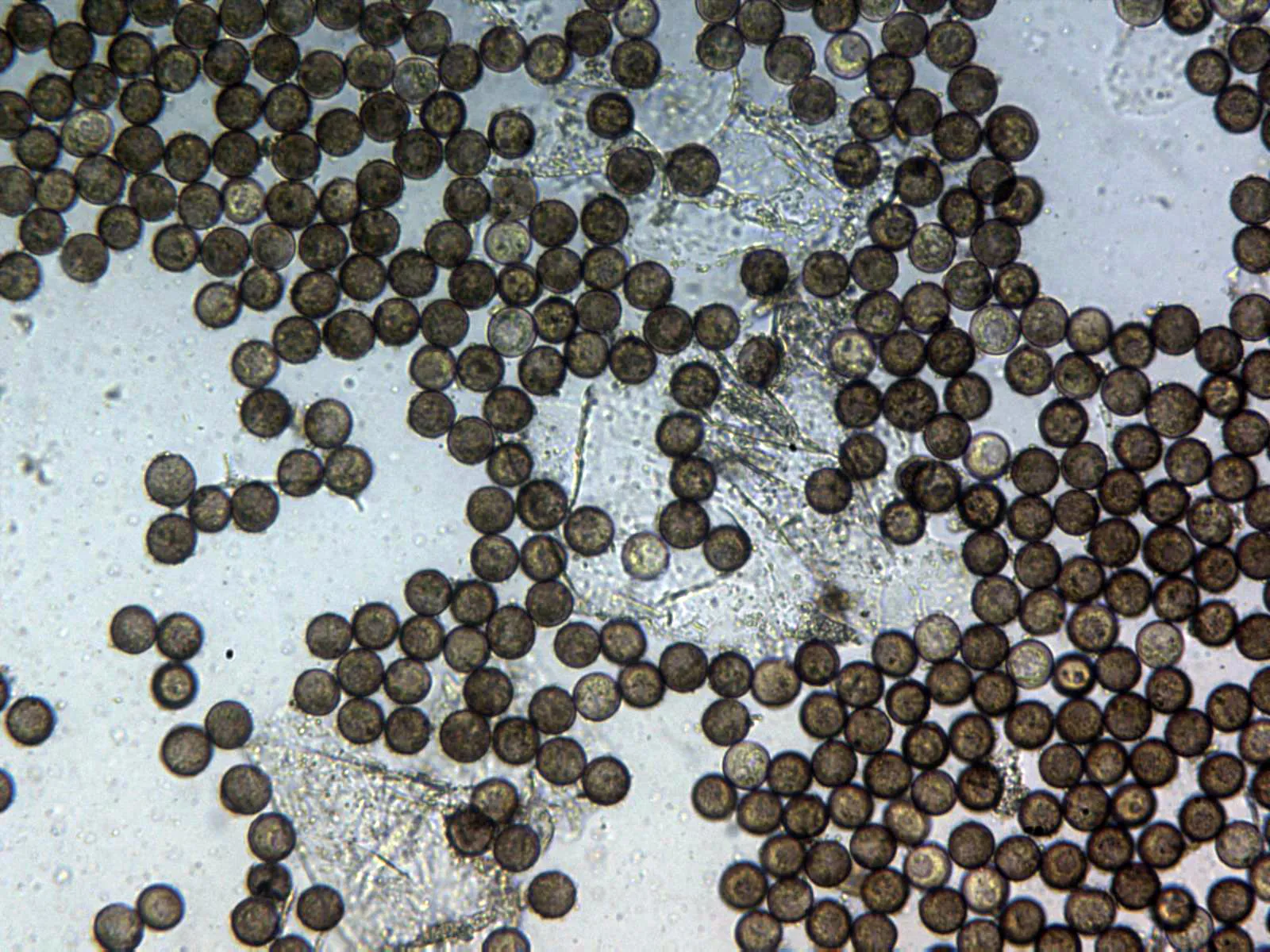 Microscopía de Leocarpus fragilis - 22 - Capilicio y esporas x 400